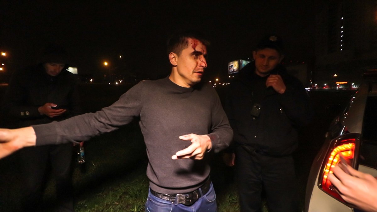 Мужчина имел признаки алкогольного опьянения, ему предложили пройти тест на наличие алкоголя в крови