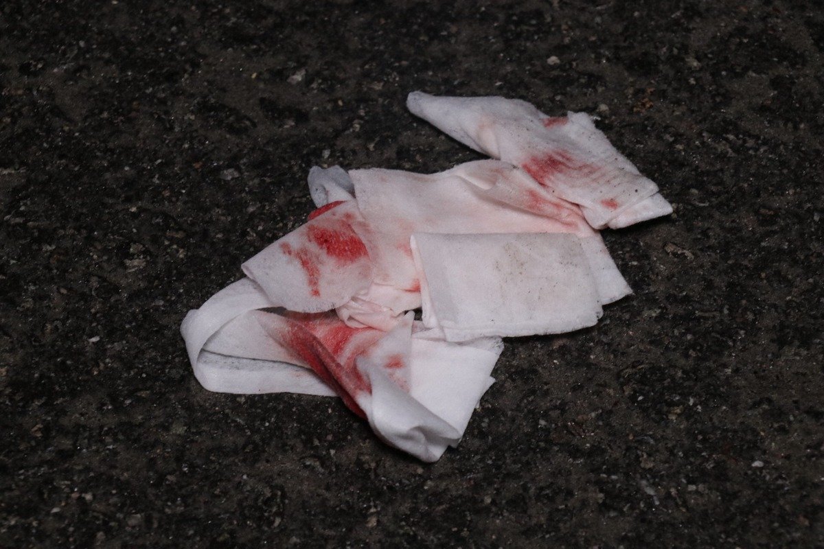 Участники ДТП получили различные травмы