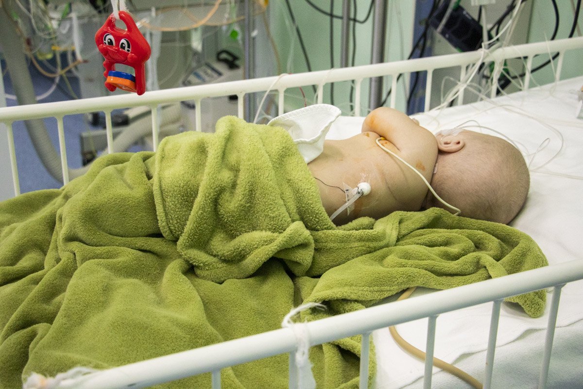 Пробег под каштанами Пробег под каштанами