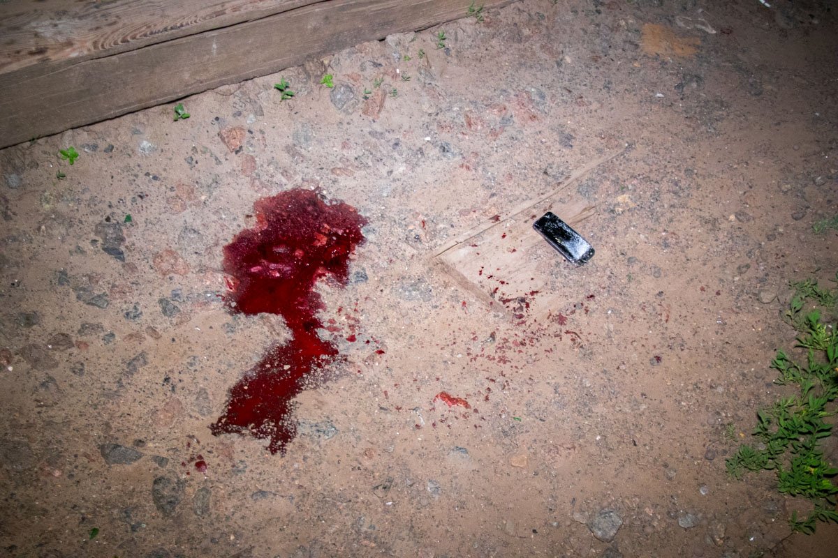 Пострадавшего мужчину госпитализировали в больницу