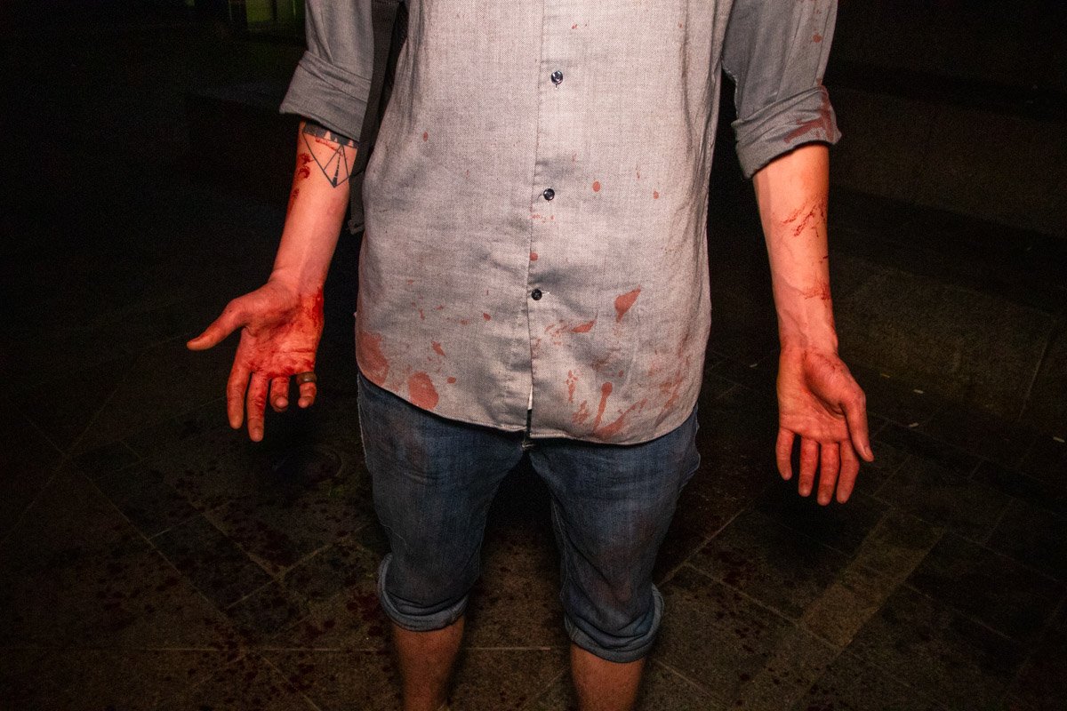 Товарищ пострадавшего тоже был весь в крови