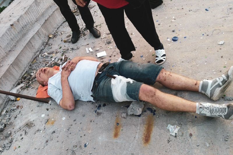 В Киеве на стройке мужчина проткнул ногу металлическим прутом