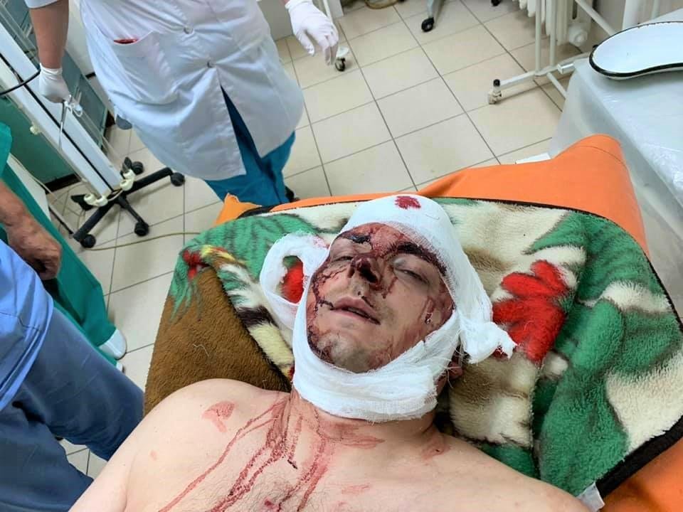 Под Сумами жестоко избили бывшего мэра Конотопа Под Сумами жестоко избили бывшего мэра Конотопа