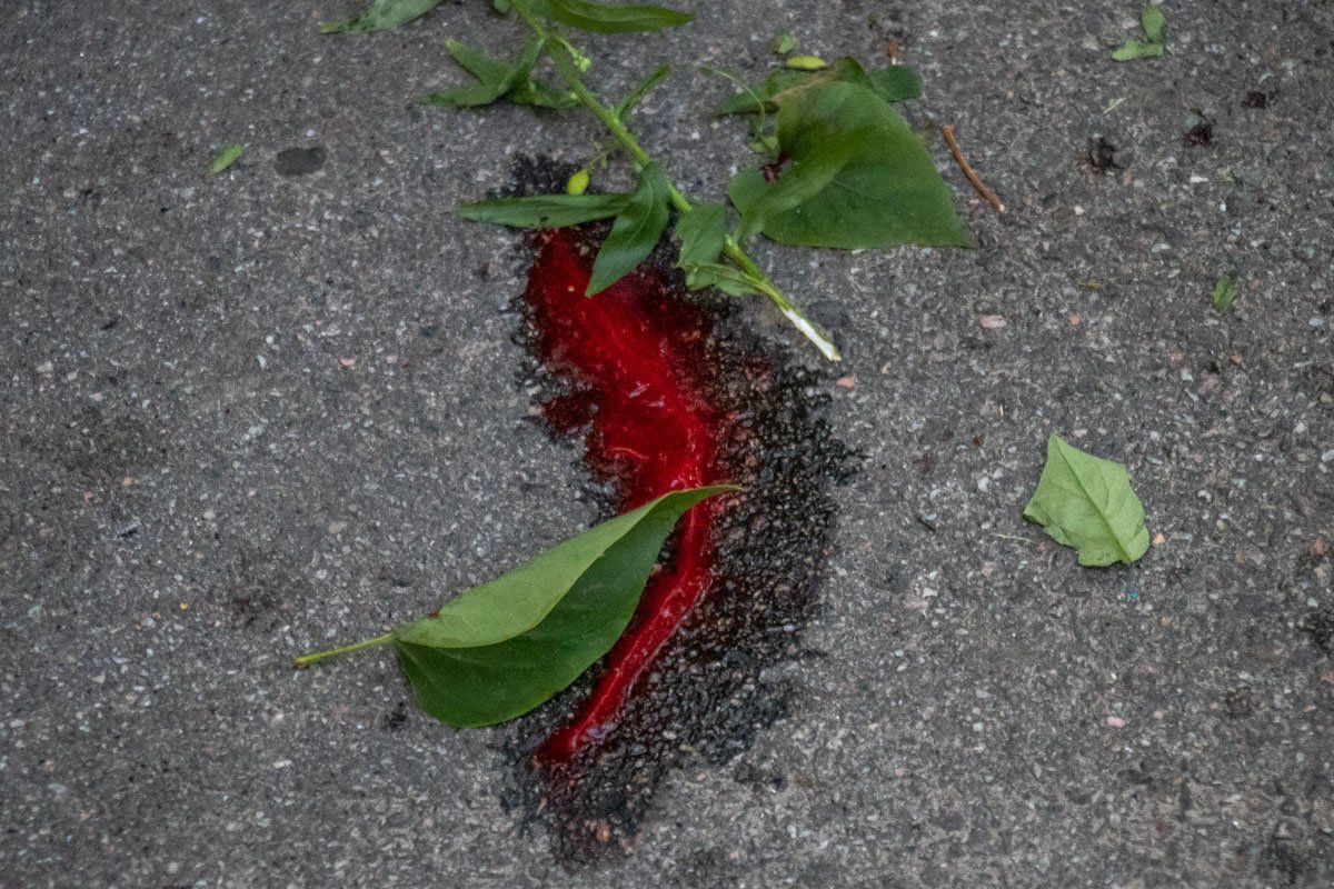 Пострадавшую госпитализировали в больницу