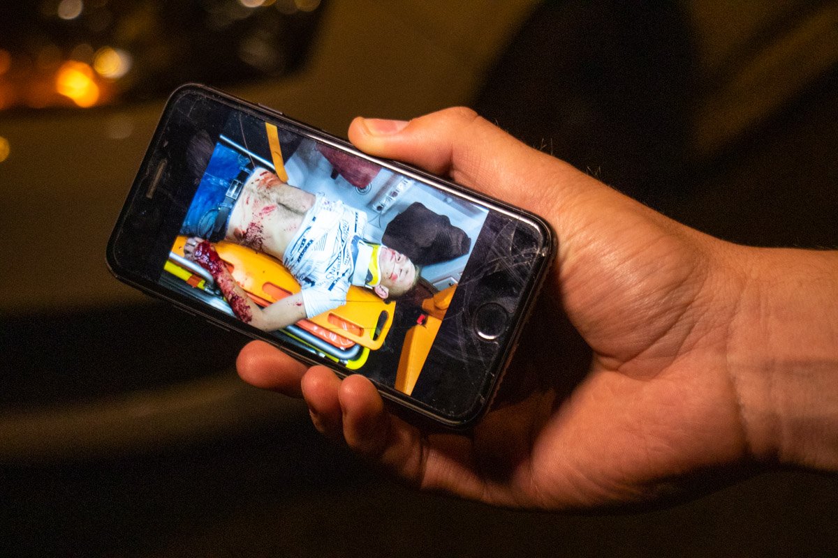 Медики диагностировали у мужчины переломы ног, рваные раны и закрытую черепно-мозговую травму Медики диагностировали у мужчины переломы ног, рваные раны и закрытую черепно-мозговую травму