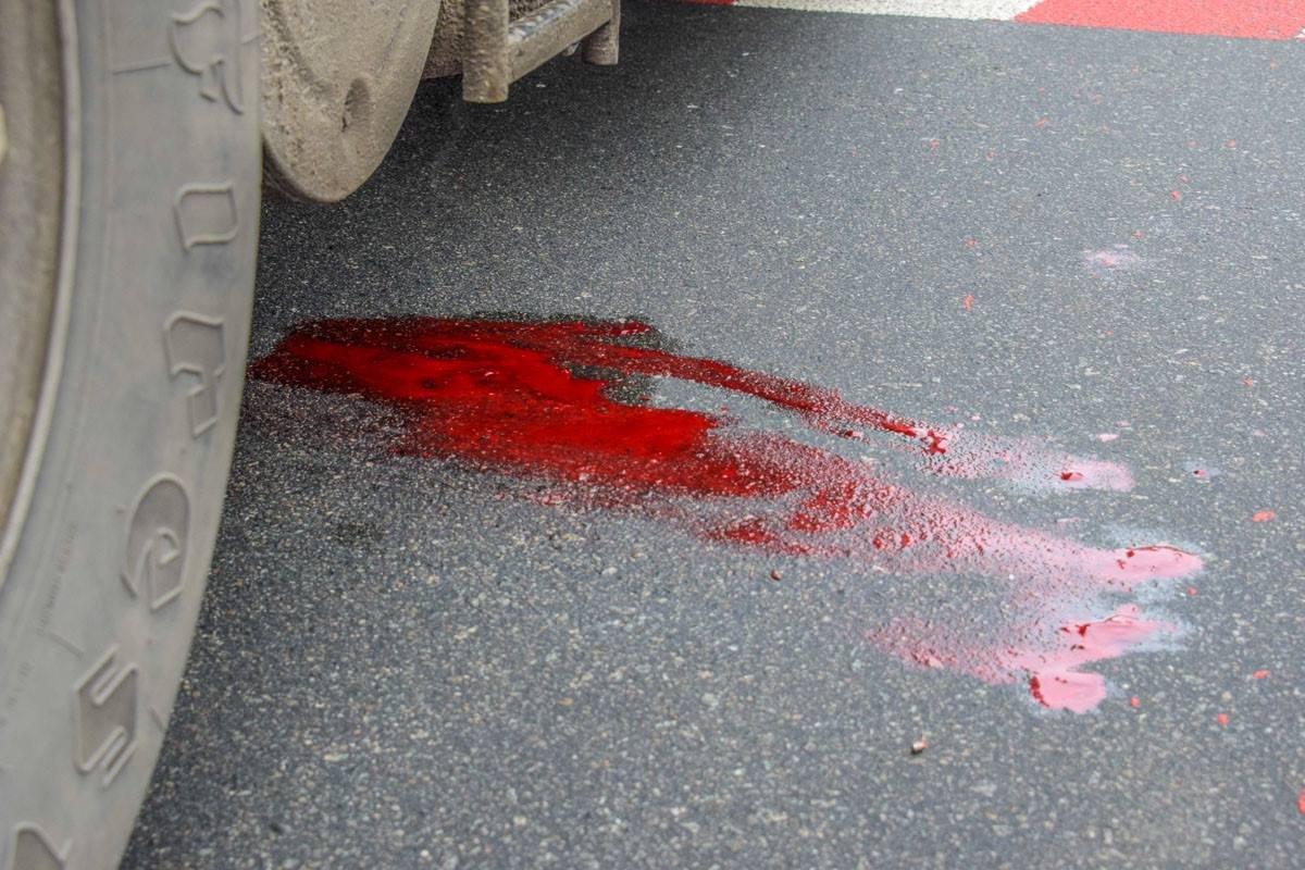 Фура переехала бабушку. Особенно "досталось" ее правой руке, говорят очевидцы Фура переехала бабушку. Особенно "досталось" ее правой руке, говорят очевидцы