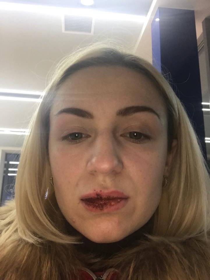 Пассажирка Елена, которую водитель такси ударил по лицу