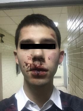 В результате инцидента у парня разбито лицо, травмирован палец и подвернута нога ВВ результате инцидента у парня разбито лицо, травмирован палец и подвернута нога