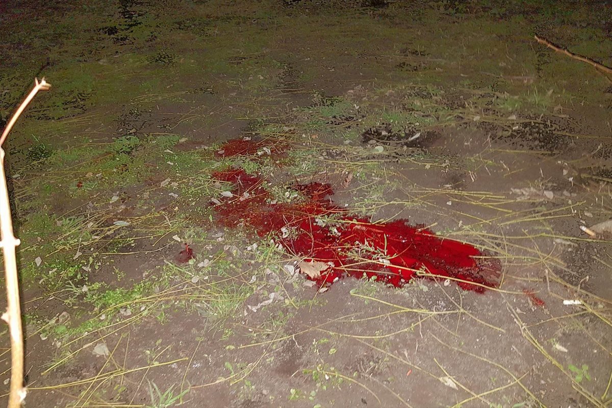 У погибшего выжить шансов не было У погибшего выжить шансов не было