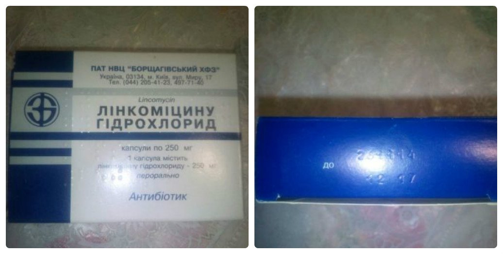 Просроченное лекарство, Кот Бегемот и рваные тапочки-собачки: ТОП странных вещей, которые можно бесплатно получить в Киеве 5