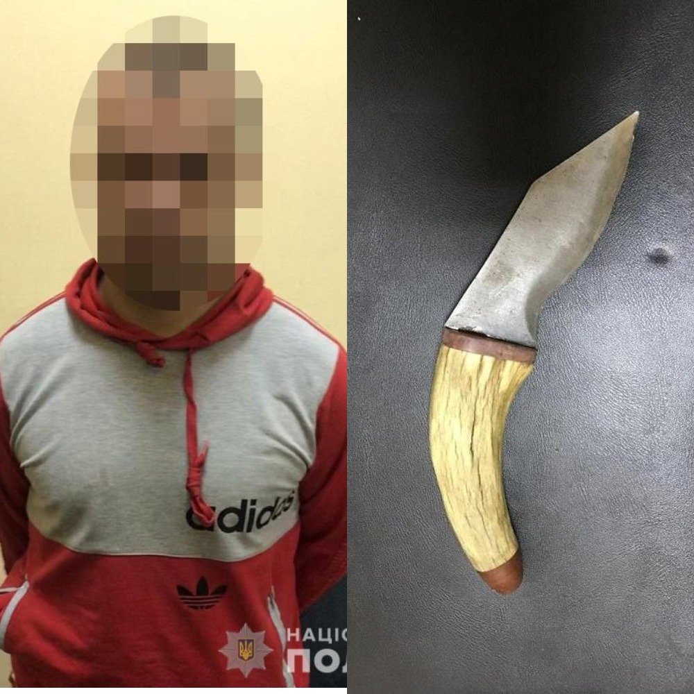 Мужчина порезал пальцы на руках ребенку прямо на детской площадке