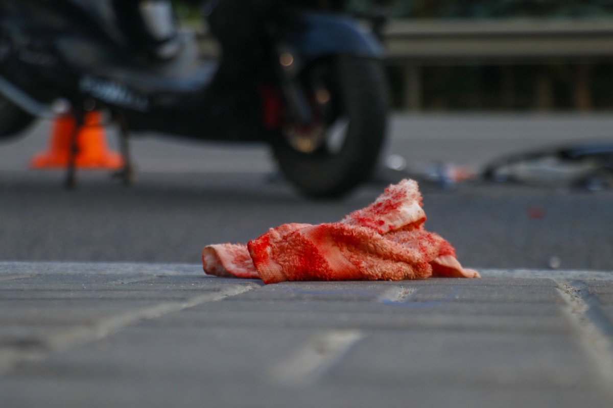 Водителя двухколесного транспорта увезла "скорая" с различными травмами тяжести