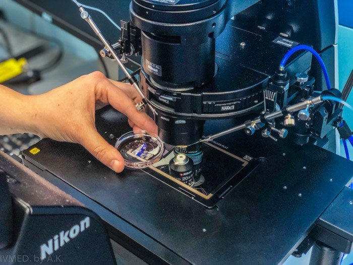 Затянувшееся ожидание или бесплодие: есть решение! 1