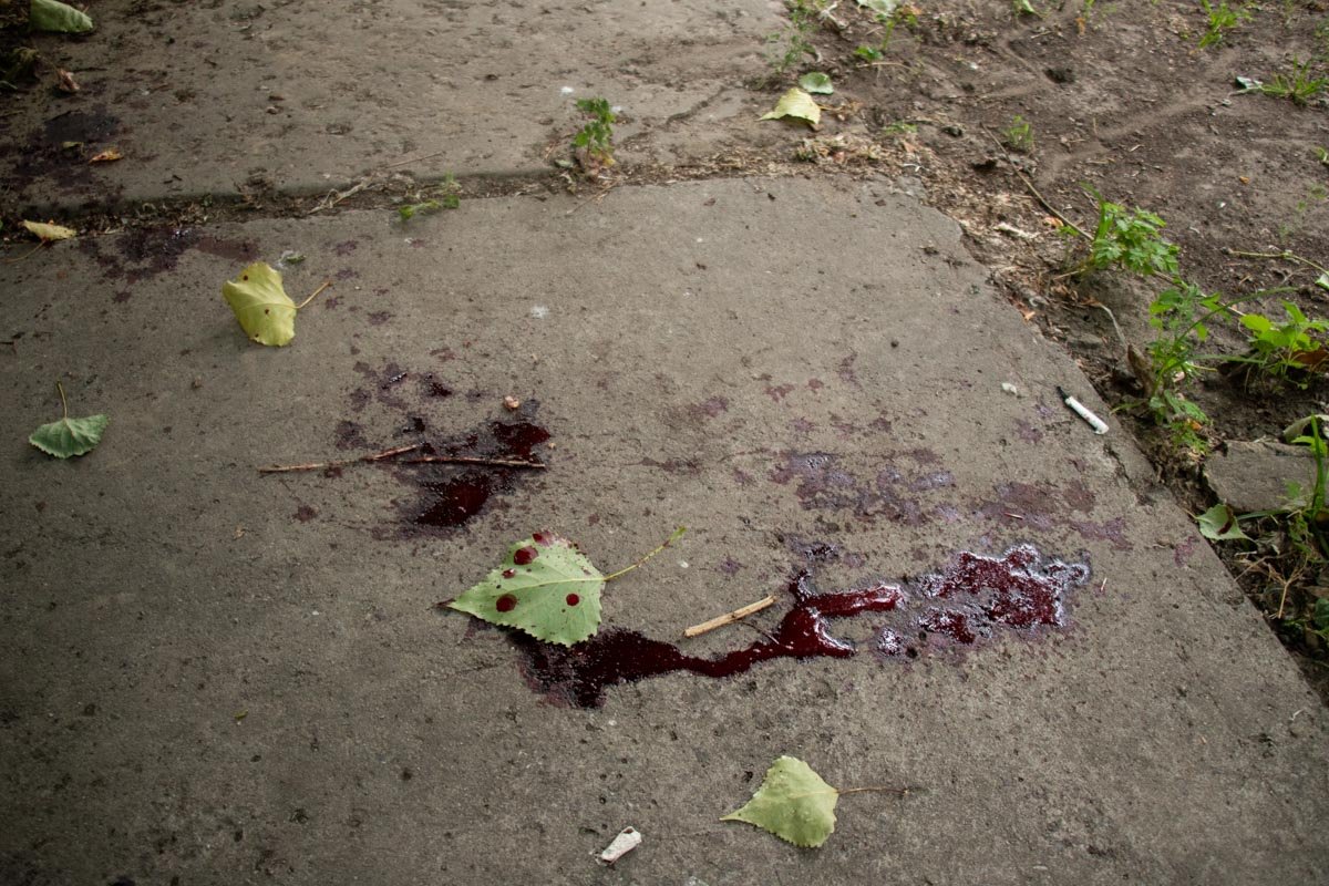 Мужчина находился прямо у ворот ГКБ №17 Мужчина находился прямо у ворот ГКБ №17