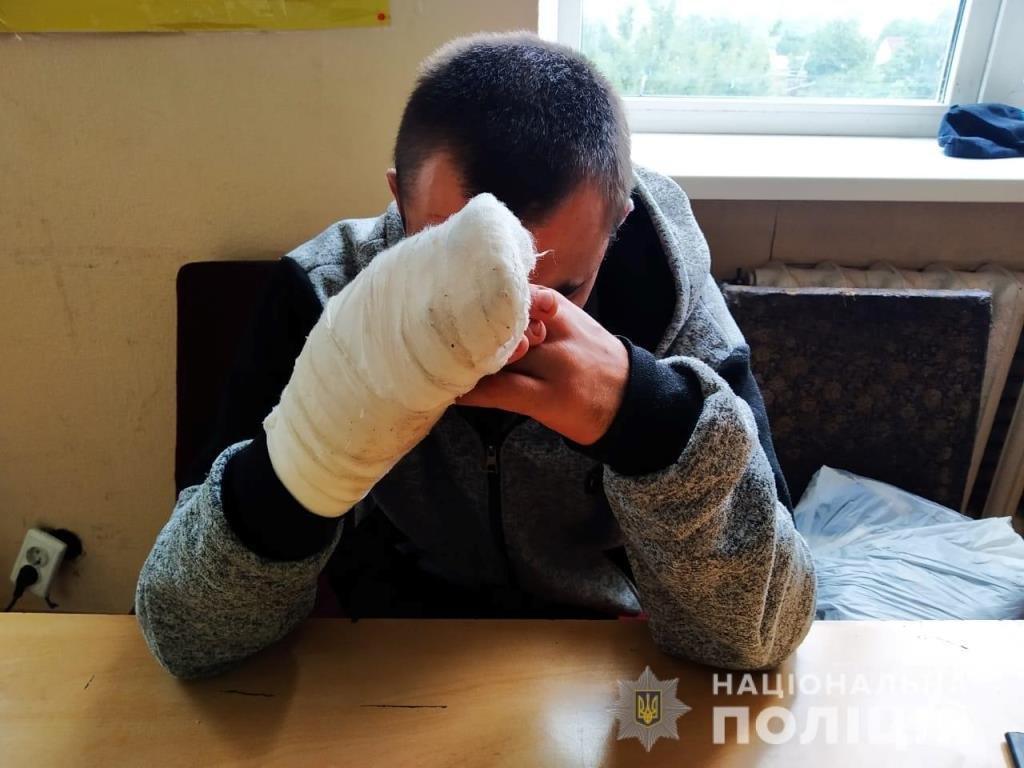 Мужчина во время ссоры порезал горло своей жене