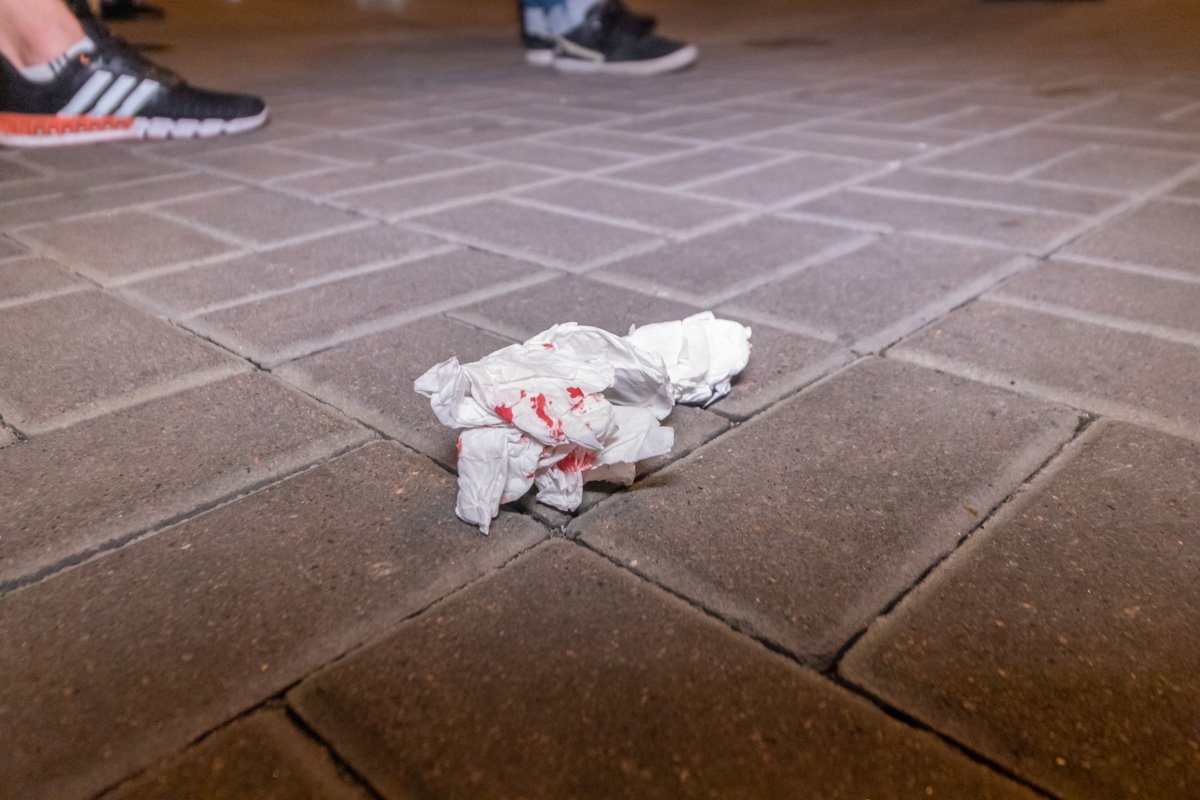 К счастью, их травм не значительные