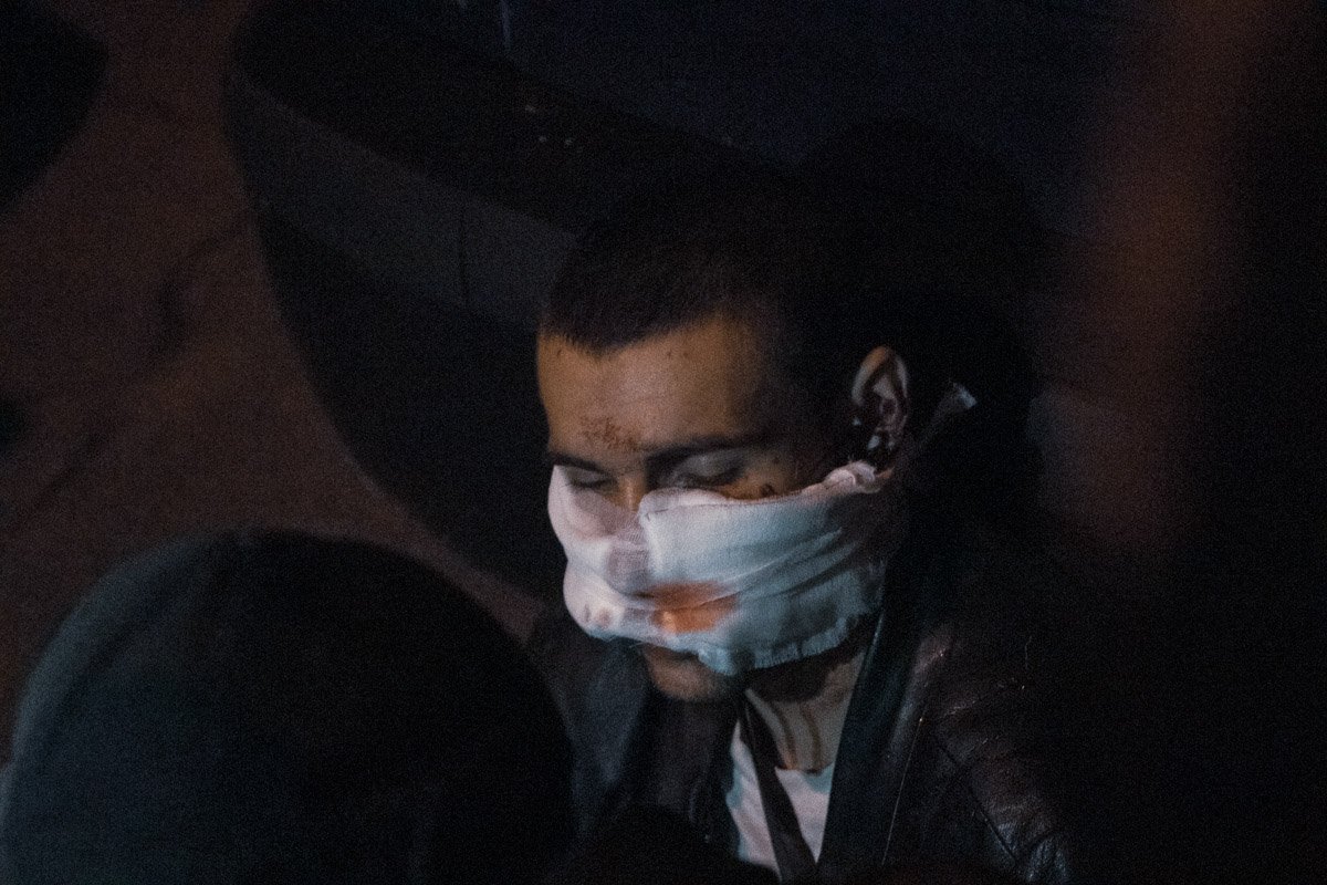 Злоумышленнику прострелили щеку 