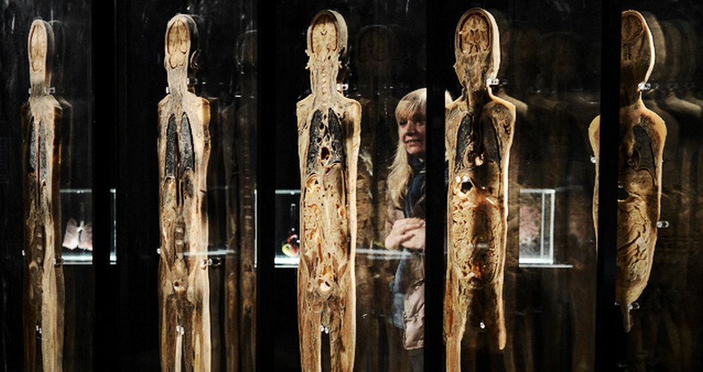 Выставка тел пугает и многое объясняет одновременно Выставка тел пугает и многое объясняет одновременно