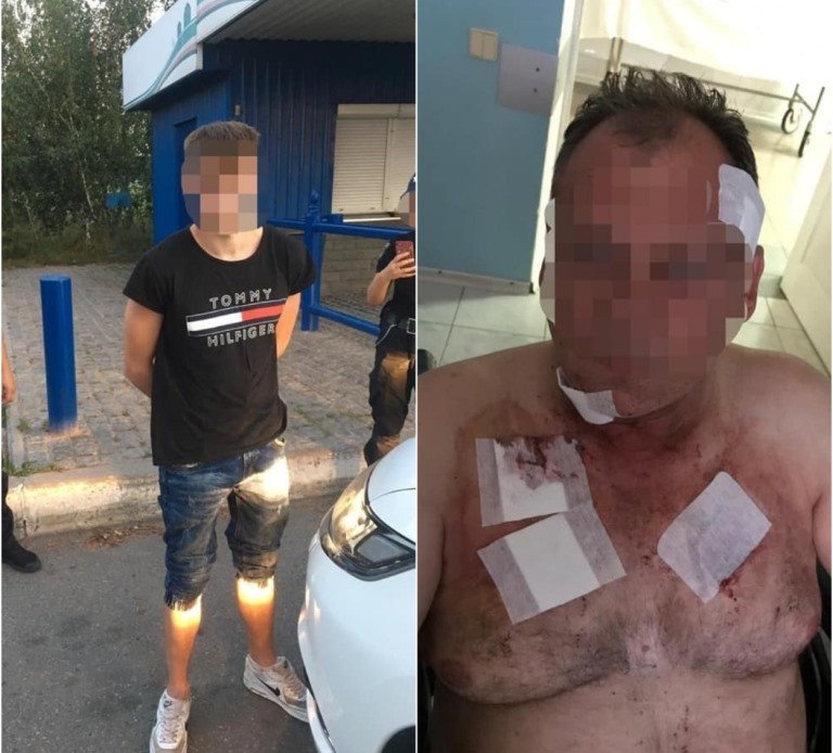 В Киеве 18-летний парень напал на таксиста и изрезал его ножом В Киеве 18-летний парень напал на таксиста и изрезал его ножом