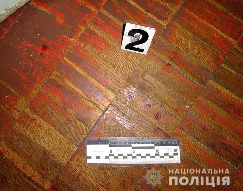 К счастью, женщина пережила нападение