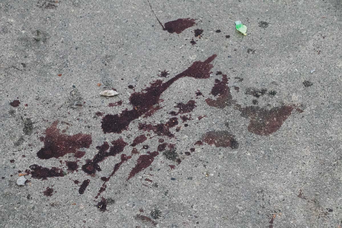 Двое пешеходов получили тяжелые травмы Двое пешеходов получили тяжелые травмы