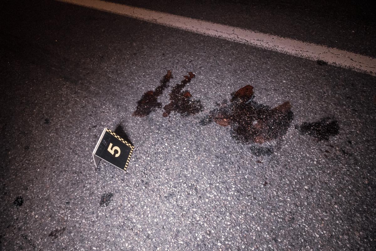 Пешехода с травмой голеностопа госпитализировали в Киевскую городскую клиническую больницу №17