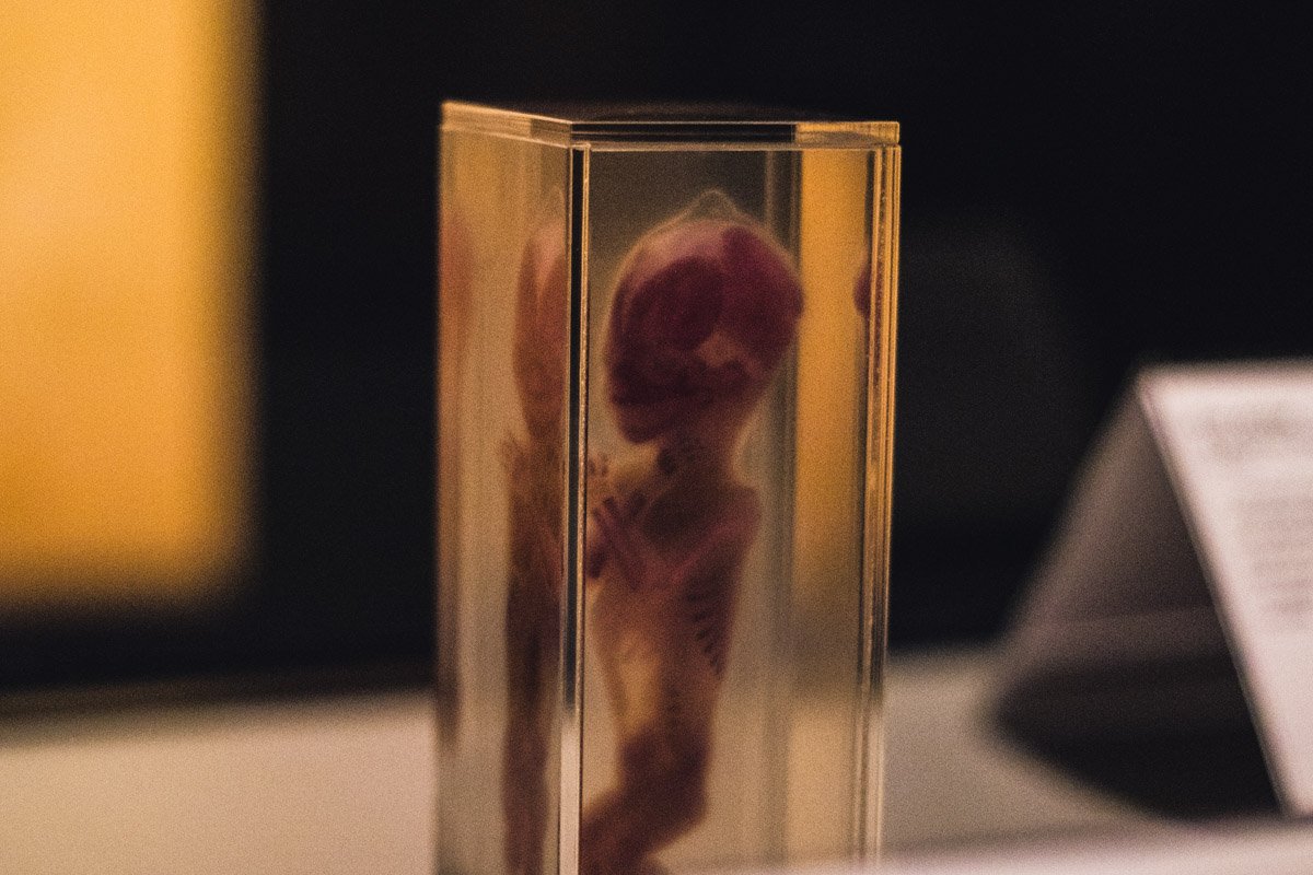 А так выглядит человеческий эмбрион 