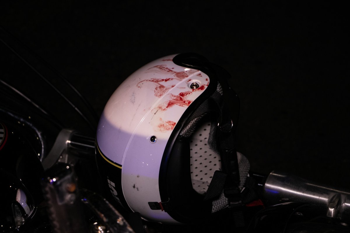 Мужчина получил множественные травмы Мужчина получил множественные травмы