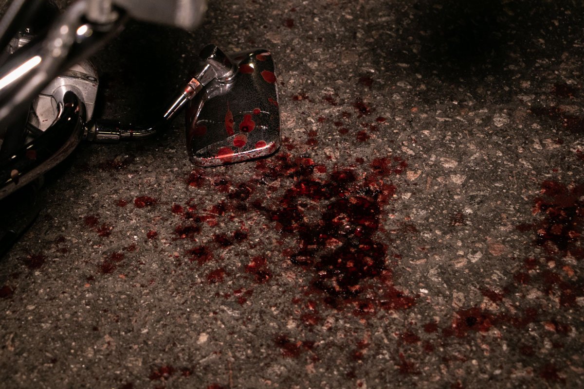 У байкера диагностировали политравму и забрали в больницу У байкера диагностировали политравму и забрали в больницу