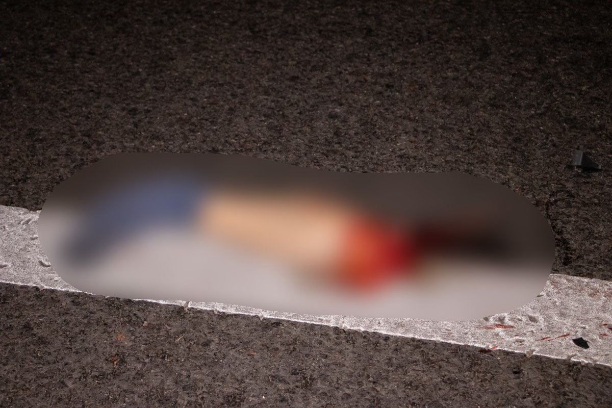 От столкновения женщине оторвало ногу