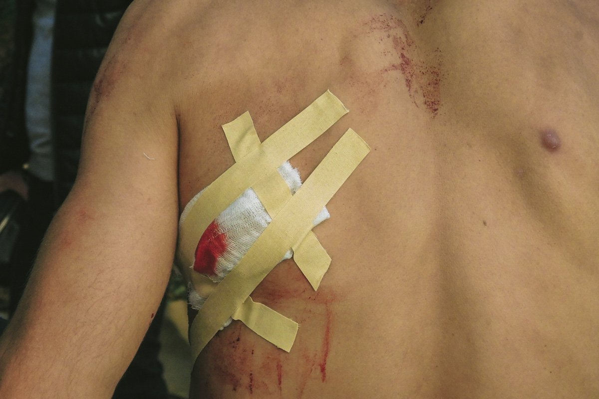 Подозреваемый с ножом скрылся в сторону Дворца спорта 