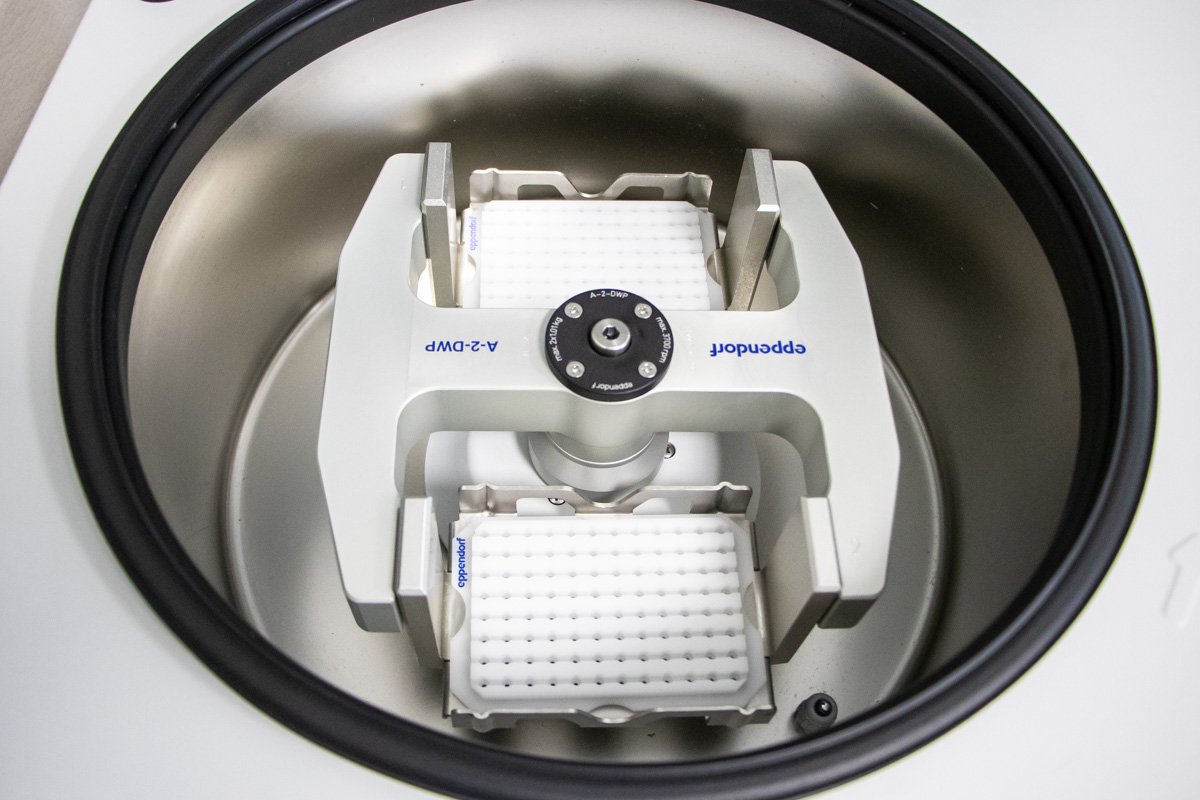 Больница Охматдет получила уникальную центрифугу для лечения детей Больница Охматдет получила уникальную центрифугу для лечения детей