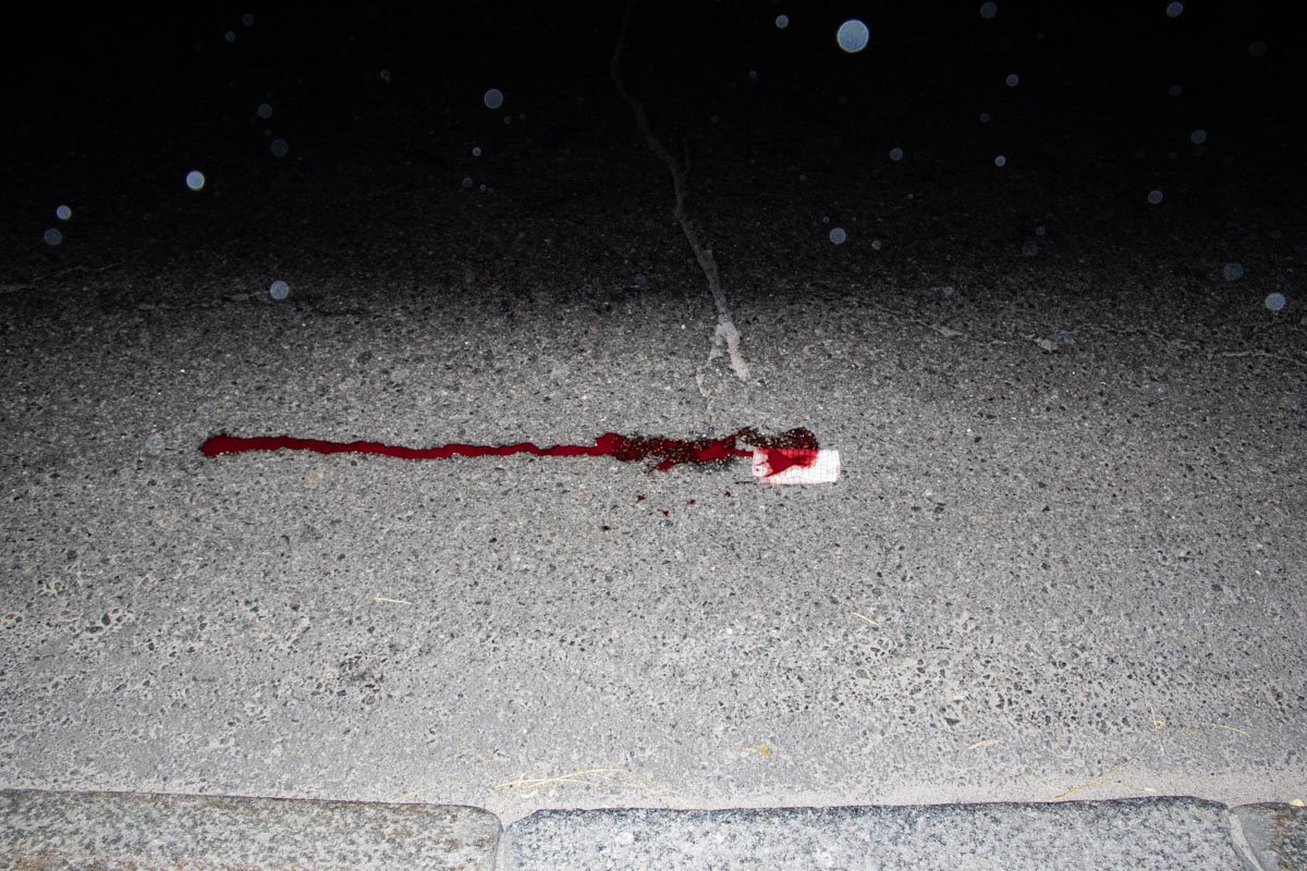 Пешеход ударился головой об асфальт и впал в кому 