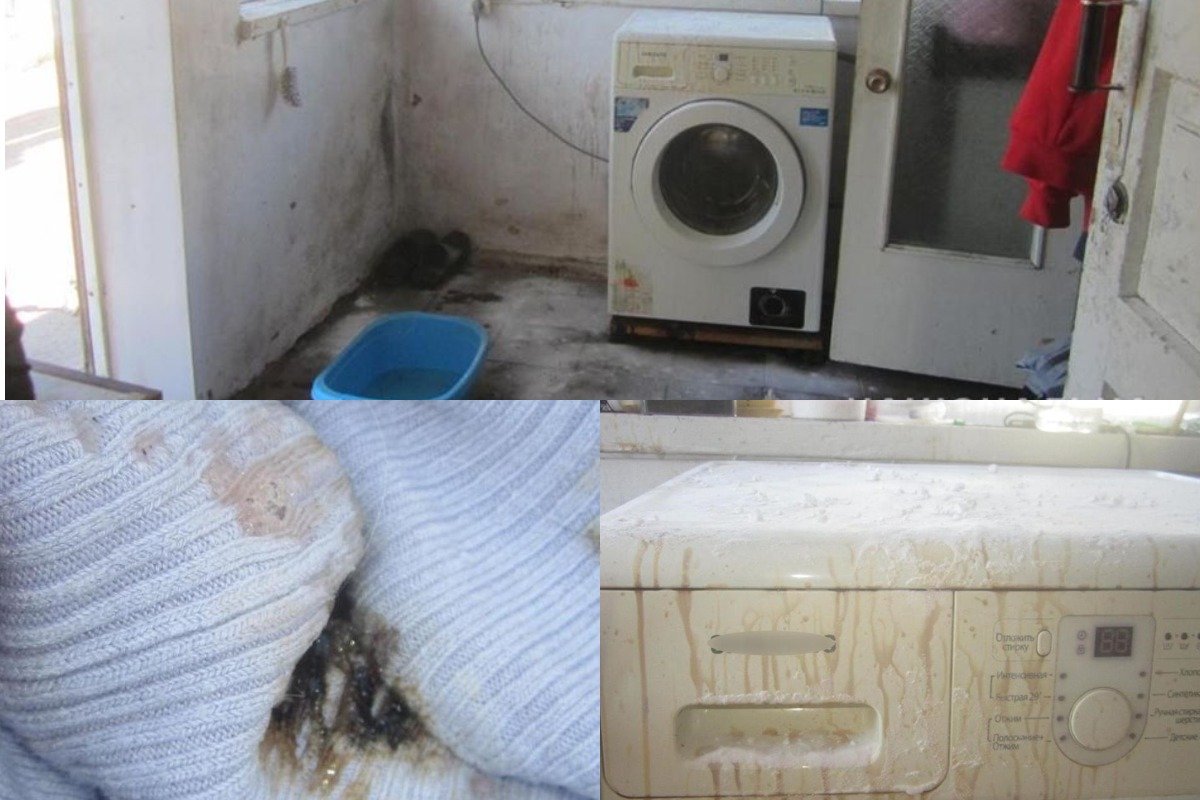 Под Киевом мужчина облил жену кислотой из-за ревности Под Киевом мужчина облил жену кислотой из-за ревности