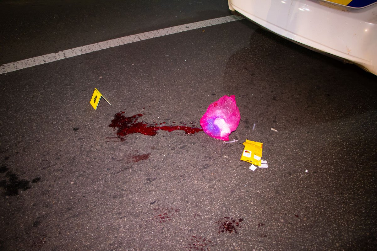 В результате аварии пешехода протянуло на пару метров вперед, потом его сразу госпитализировали В результате аварии пешехода протянуло на пару метров вперед, потом его сразу госпитализировали