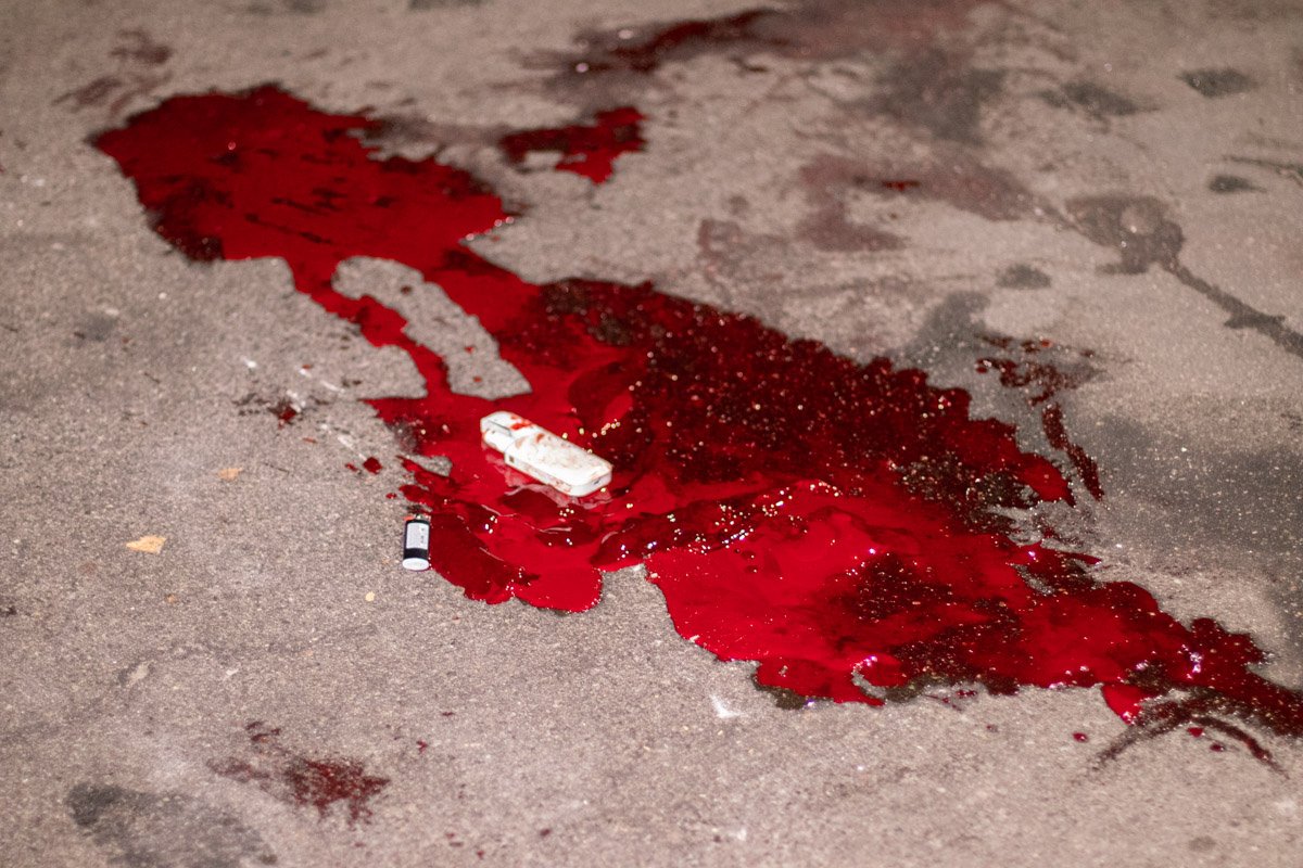 Он получил травмы несовместимые с жизнью