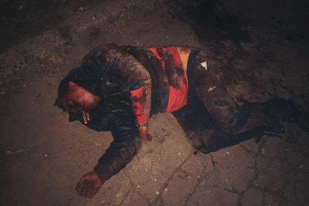 Пострадавшего мужчину забрали в больницу в тяжелом состоянии Пострадавшего мужчину забрали в больницу в тяжелом состоянии