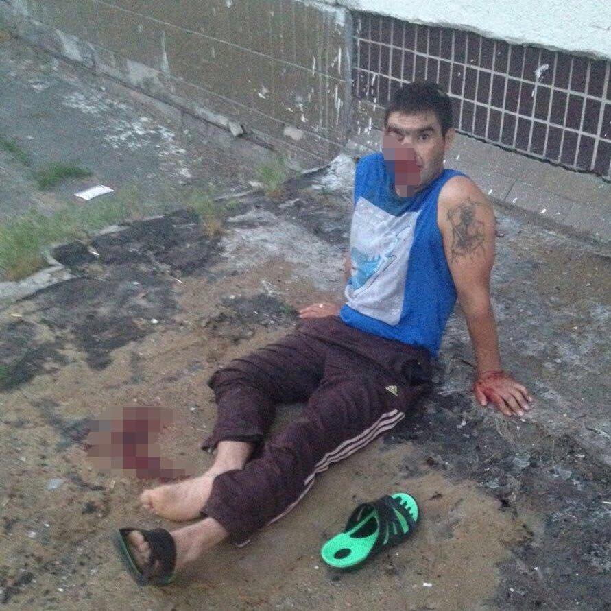 В Киеве из окна больницы выпал нетрезвый пациент 1