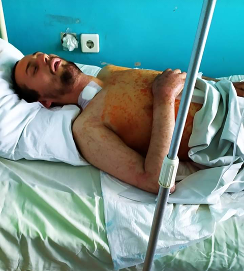 В Киеве мужчину 10 раз проткнули заточкой возле парка "Партизанской славы": родственники ищут свидетелей 1