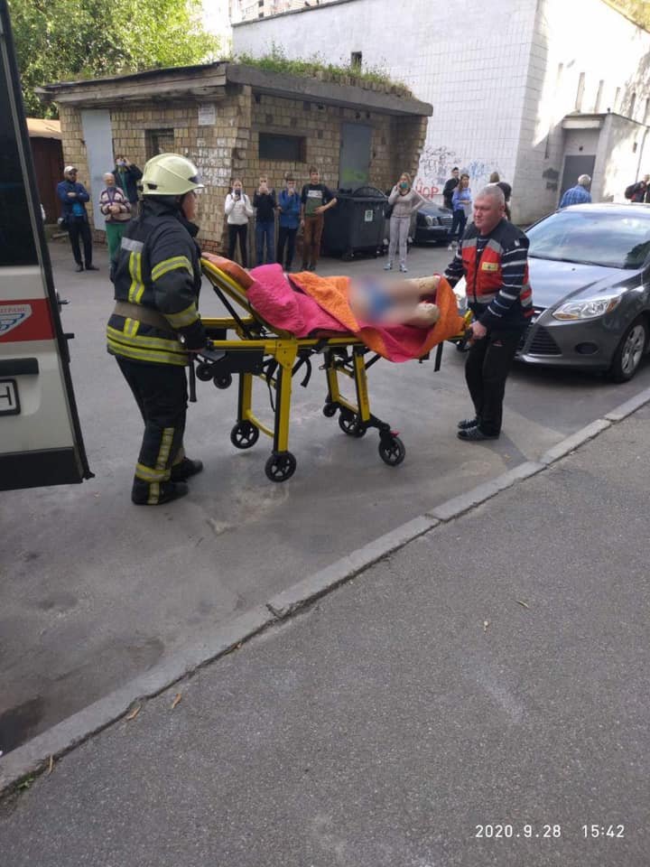 В Киеве из горящей квартиры спасли мужчину с множественными ожогами 2