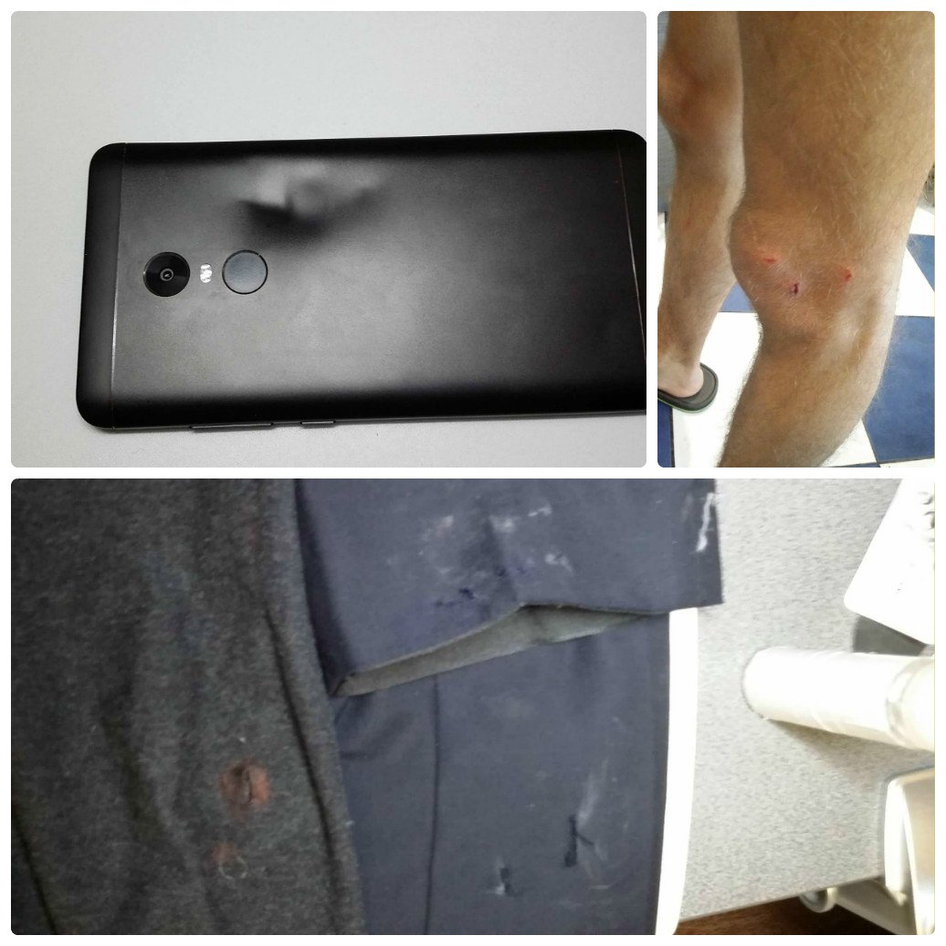 У парня травмирована нога и поврежден корпус мобильного телефона