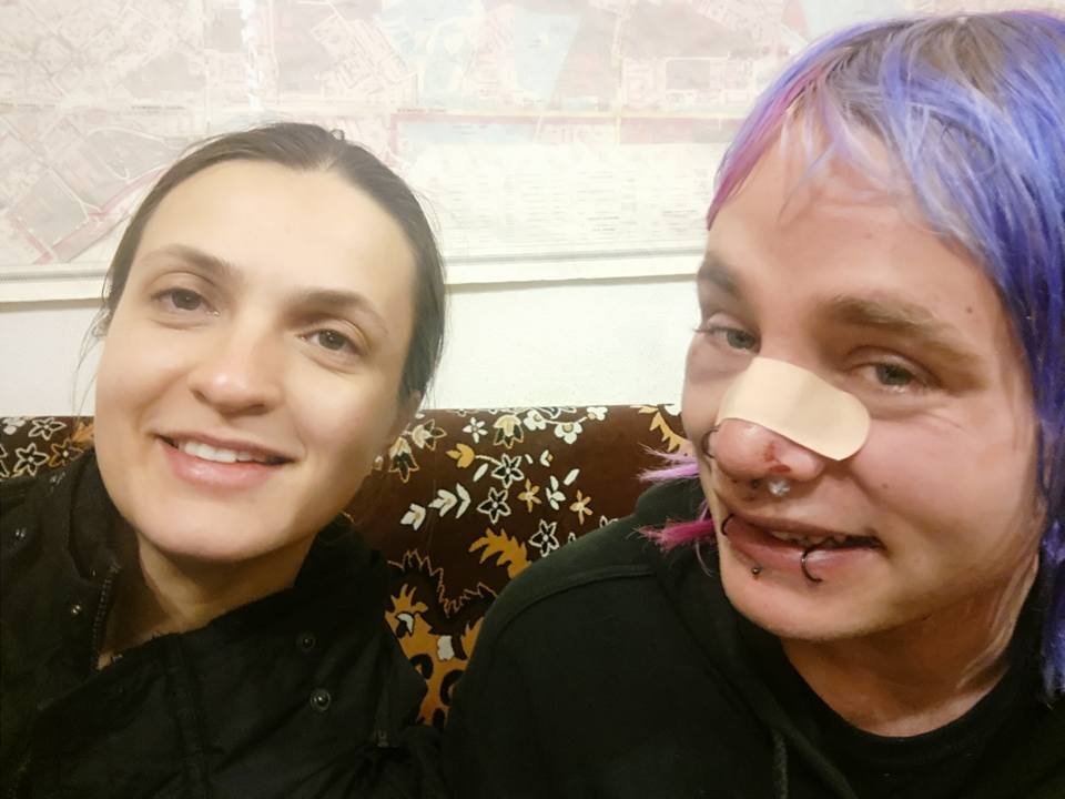 Туриста из Британии избили ради развлечения из-за его внешности Туриста из Британии избили ради развлечения из-за его внешности