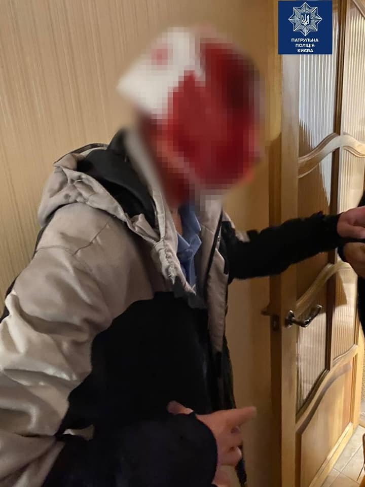 В Киеве муж ударил жену ногой в челюсть и получил в ответ утюгом по голове 2