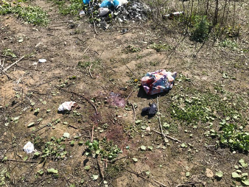 В Киеве нашли сумку с обезглавленным телом человека: первые подробности, фото и видео с места происшествия 3