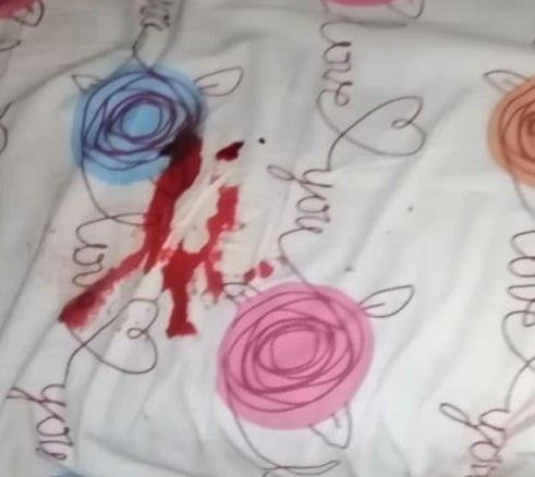 Порезал 8-летнего мальчика и сломал нос 14-летней девочке: под Киевом мужчина залез в дом посреди ночи и напал на детей 1