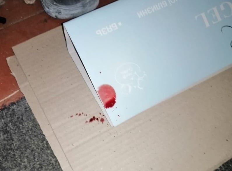 Порезал 8-летнего мальчика и сломал нос 14-летней девочке: под Киевом мужчина залез в дом посреди ночи и напал на детей 4