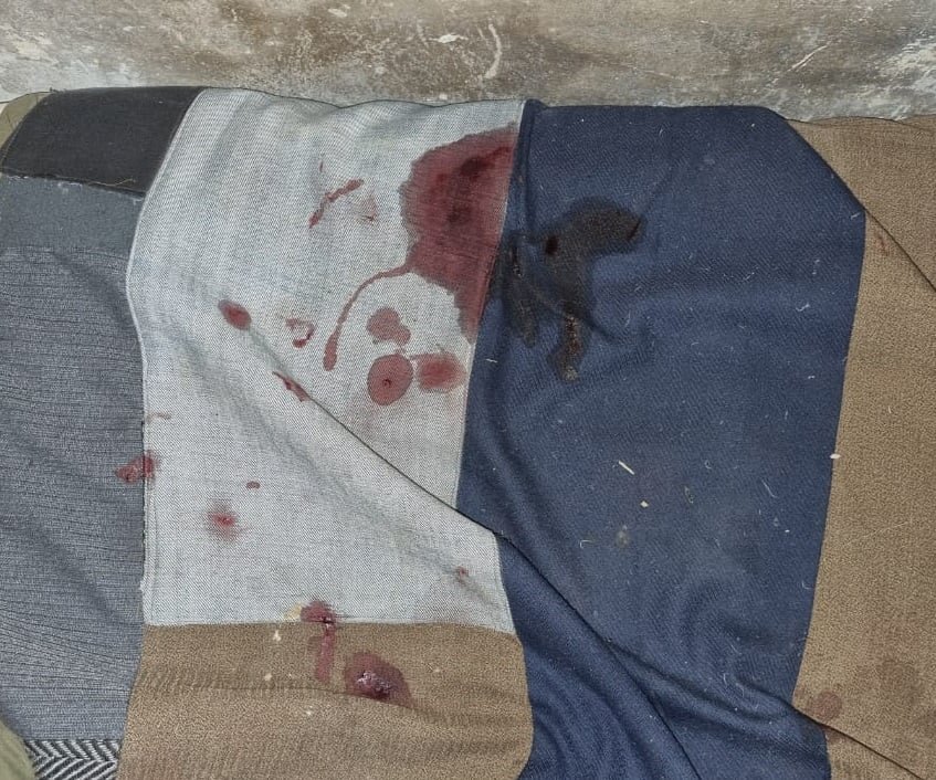 Колотые раны груди и живота: как под Киевом мужчина застал жену в постели своего друга 2