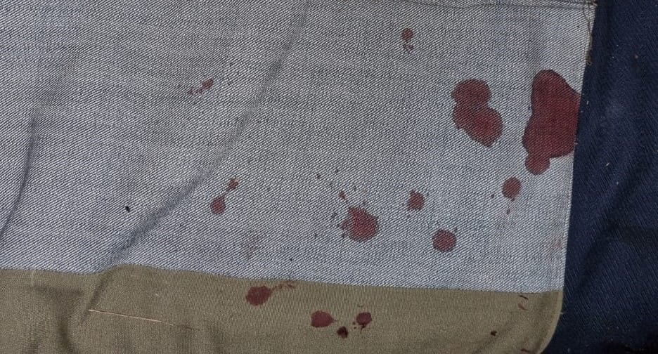 Колотые раны груди и живота: как под Киевом мужчина застал жену в постели своего друга 3