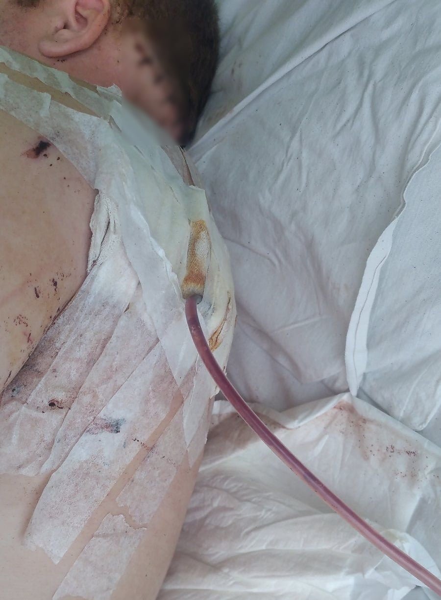 В Киевской области мужчина пришел к бывшей и напал с ножом на ее нового любовника 1