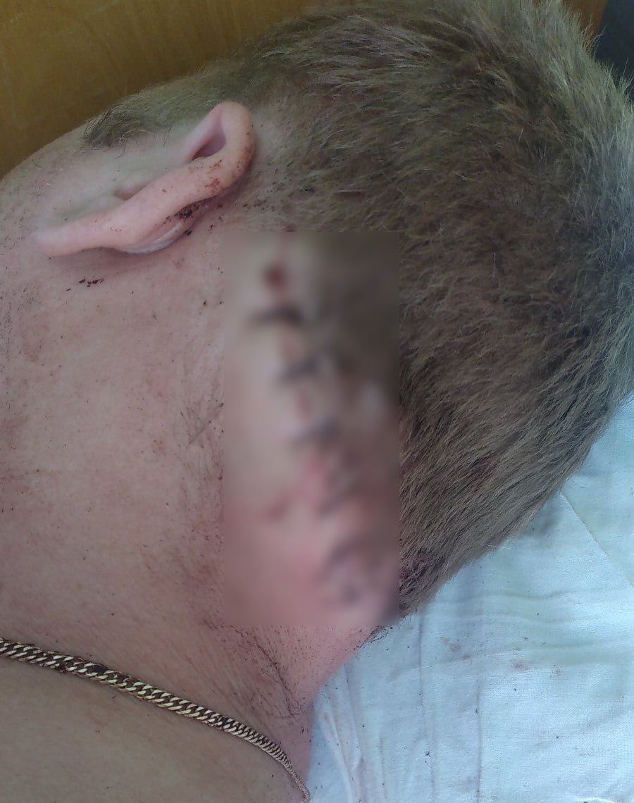 В Киевской области мужчина пришел к бывшей и напал с ножом на ее нового любовника 2